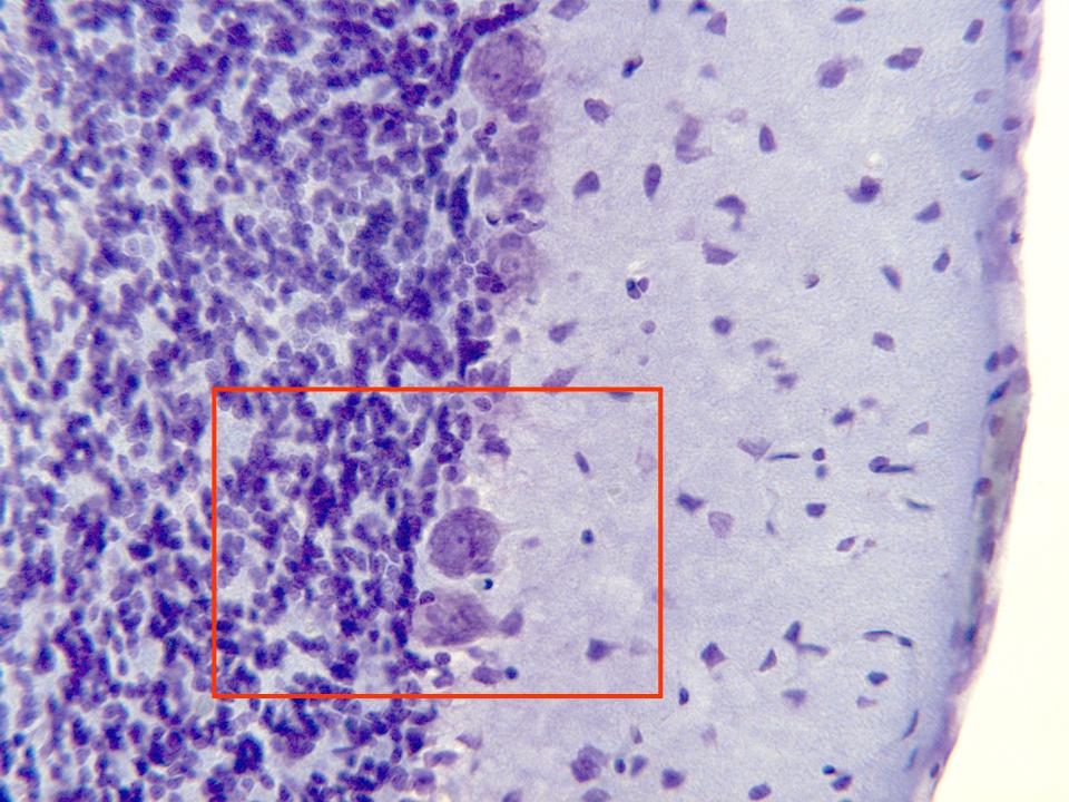 Resultado de imagen de Pueden apreciarse aquÃ­, con el objetivo de 40x, las tres capas de cÃ©lulas nerviosas que integran la corteza cerebelosa: capa molecular, capa de cÃ©lula de Purkinje y capa granular