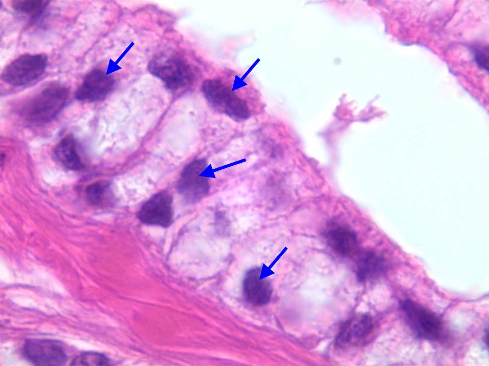 celulas de la prostata