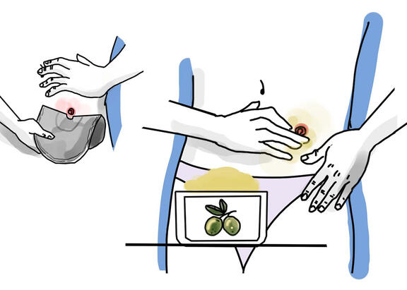 Ilustración de la aplicación del producto en pacientes.